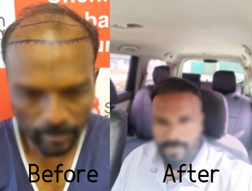 BeforeAfter2