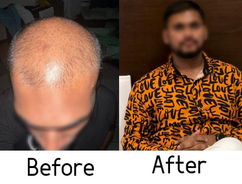 BeforeAfter3