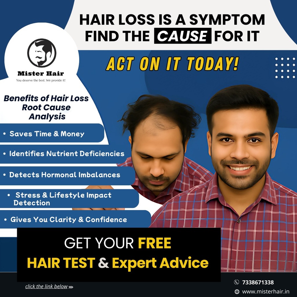 Achieve a Fuller Head of Hair with Bangalore Hair Transplant at Mister Hair