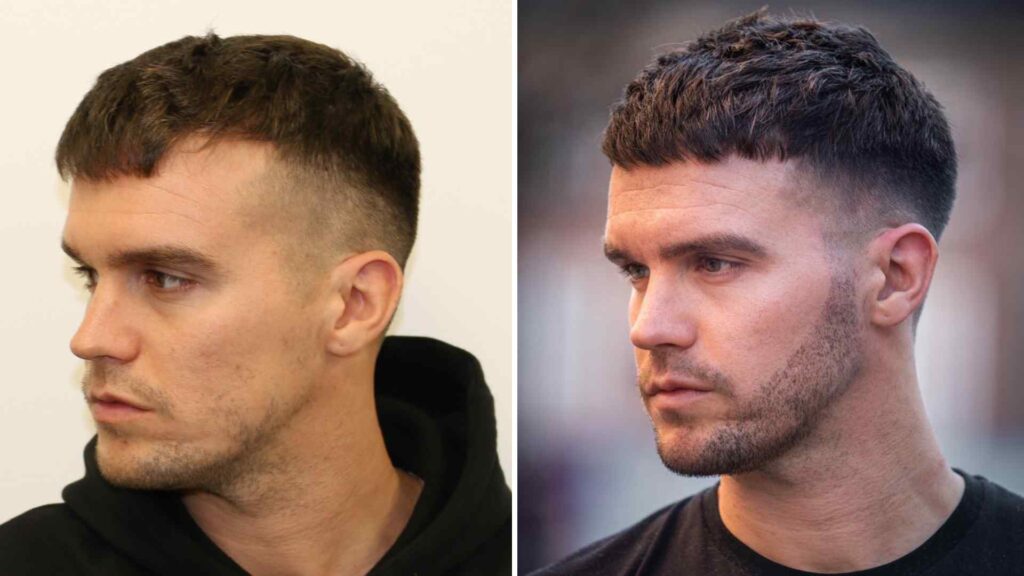 Gym Supplements & Hair Loss: Complete Guide (2025)