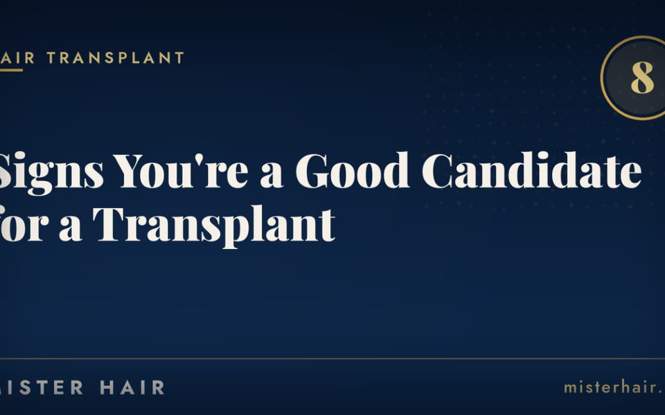 8 Signs You’re a Good Candidate for a Hair Transplant